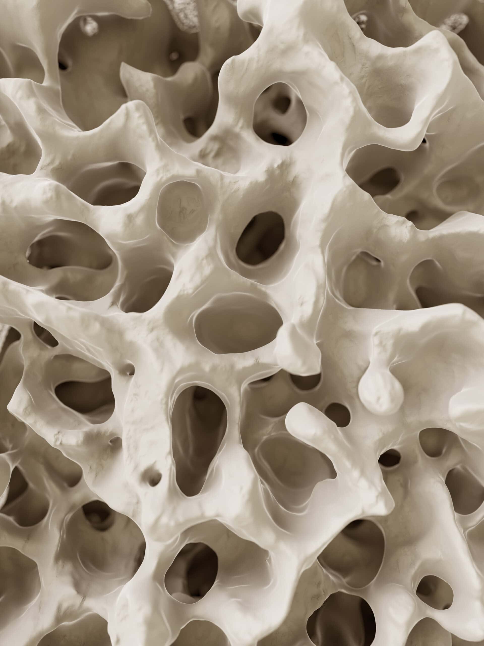 Vortragsreihe „Osteoporose verstehen und vorbeugen“